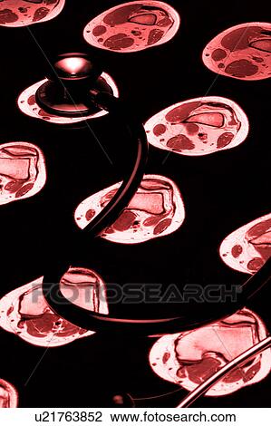 Close-up of a stethoscope View Large Photo Image Stock Image - Close-up of a stethoscope. Fotosearch