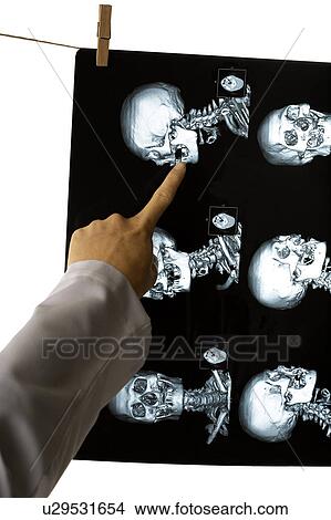 Picture - Doctor pointing at the image of CAT scan. Fotosearch