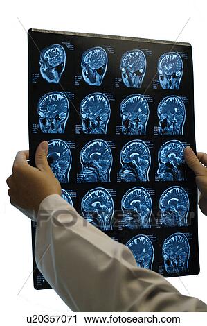Man holding medical scan of human head View Large Photo Image Stock Image - Man holding medical scan of human head. Fotosearch