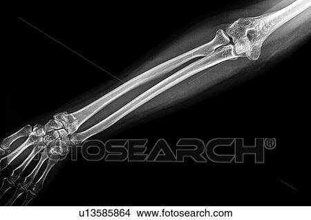 Picture - "Medical scan of human hand, close-up". Fotosearch