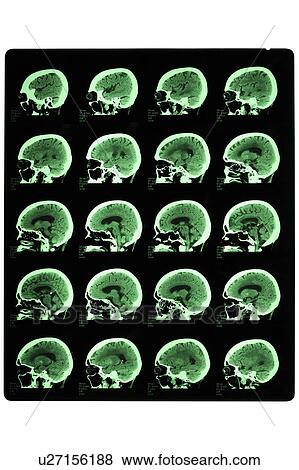 Stock Photo - "Medical scan of human head, close-up". Fotosearch