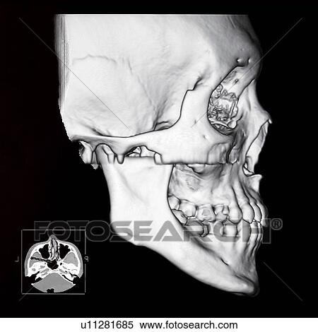 Stock Photography - "Medical scan of human head, close-up". Fotosearch