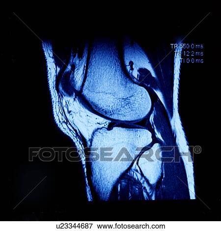 Stock Photo - "MRI scan of abdomen, close-up". Fotosearch