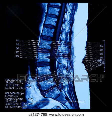 "MRI Scan of abdomen, close-up" View Large Photo Image Stock Photography - "MRI Scan of abdomen, close-up". Fotosearch