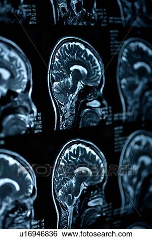 "MRI scan of human head, close-up" View Large Photo Image Stock Photograph - "MRI scan of human head, close-up". Fotosearch