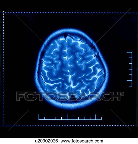 Stock Photograph - "MRI scan of human head, close-up". Fotosearch