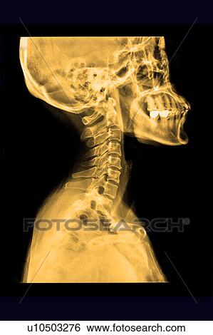 Stock Photograph - "X-ray image of human head, close-up". Fotosearch