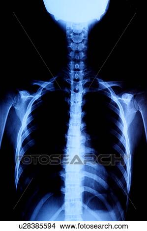 Picture - "X-ray image of human spine, close-up". Fotosearch