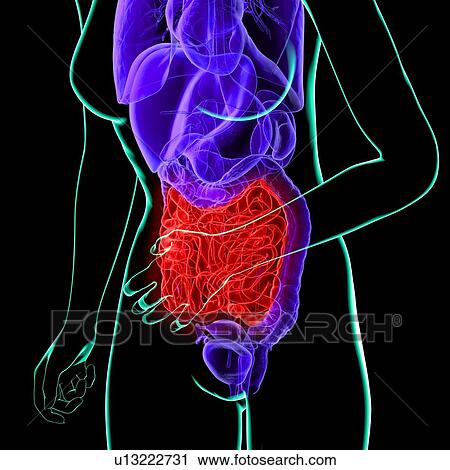 Clip Art - Abdominal pain, conceptual artwork. Fotosearch