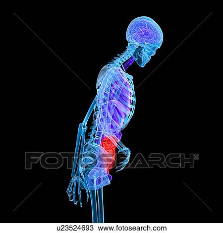 Abdominal pain, conceptual artwork View Large Illustration Drawing - Abdominal pain, conceptual artwork. Fotosearch