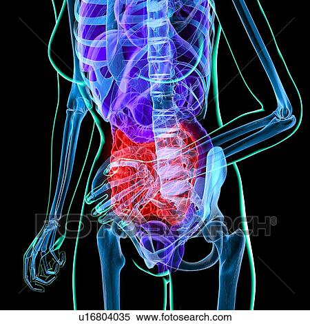 Abdominal pain, conceptual artwork View Large Illustration Stock Illustration - Abdominal pain, conceptual artwork. Fotosearch