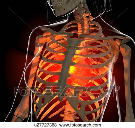 Stock Illustration - Angina, conceptual artwork. Fotosearch