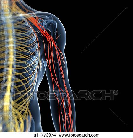 Stock Illustration - Arm pain, conceptual artwork. Fotosearch