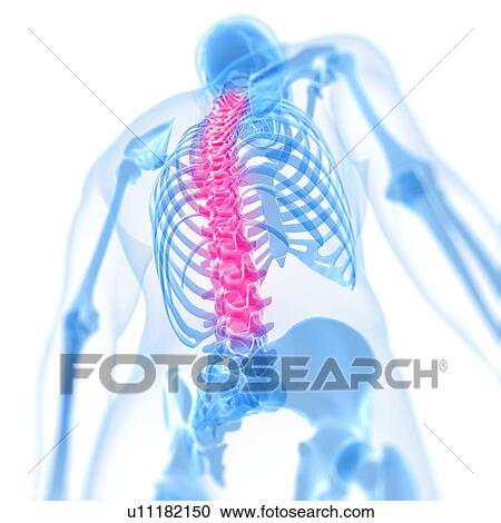 Clipart - Back pain, conceptual artwork. Fotosearch
