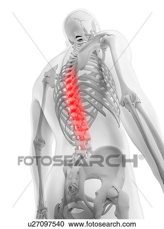 Back pain, conceptual artwork View Large Illustration Clipart - Back pain, conceptual artwork. Fotosearch