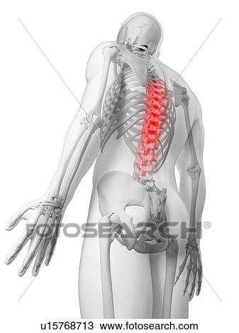 Back pain, conceptual artwork View Large Illustration Drawing - Back pain, conceptual artwork. Fotosearch