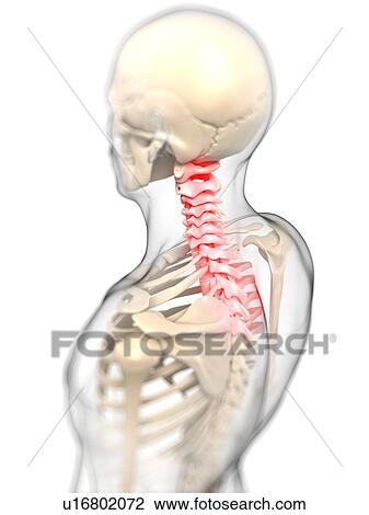 Back pain, conceptual artwork View Large Illustration Drawing - Back pain, conceptual artwork. Fotosearch