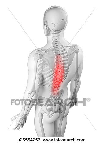 Drawing - Back pain, conceptual artwork. Fotosearch
