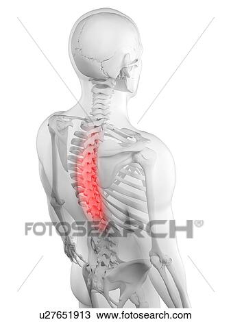 Drawing - Back pain, conceptual artwork. Fotosearch
