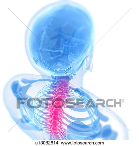 Back pain, conceptual artwork View Large Illustration Stock Illustration - Back pain, conceptual artwork. Fotosearch