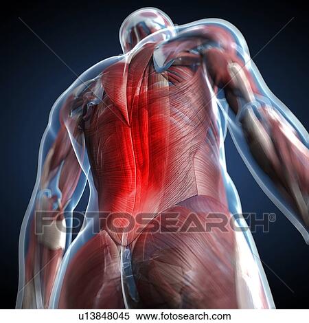 Stock Illustration - Back pain, conceptual artwork. Fotosearch