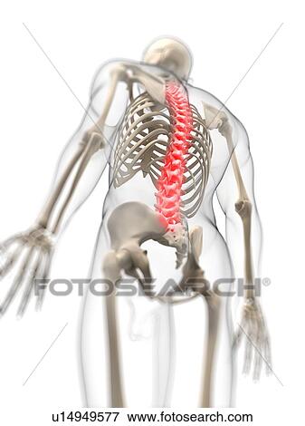 Back pain, conceptual artwork View Large Illustration Stock Illustration - Back pain, conceptual artwork. Fotosearch