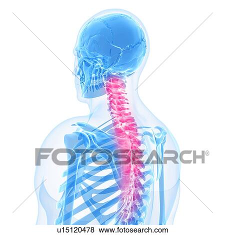 Stock Illustration - Back pain, conceptual artwork. Fotosearch