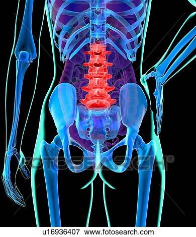 Back pain, conceptual artwork View Large Illustration Stock Illustration - Back pain, conceptual artwork. Fotosearch
