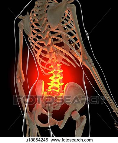 Back pain, conceptual artwork View Large Illustration Stock Illustration - Back pain, conceptual artwork. Fotosearch