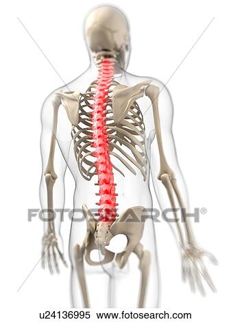 Back pain, conceptual artwork View Large Illustration Stock Illustration - Back pain, conceptual artwork. Fotosearch
