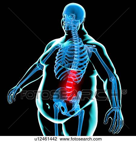 Back pain in obesity, conceptual artwork View Large Illustration Drawing - Back pain in obesity, conceptual artwork. Fotosearch