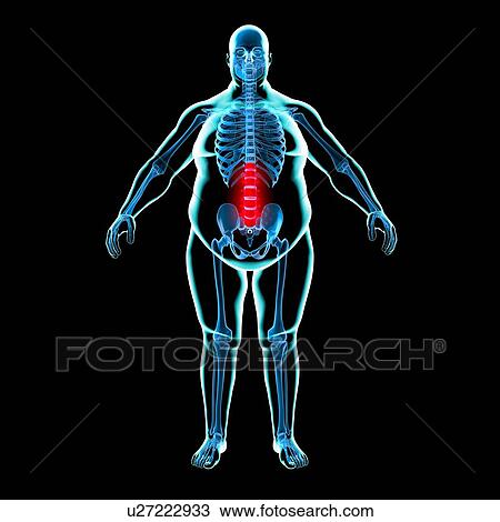 Back pain in obesity, conceptual artwork View Large Illustration Drawing - Back pain in obesity, conceptual artwork. Fotosearch