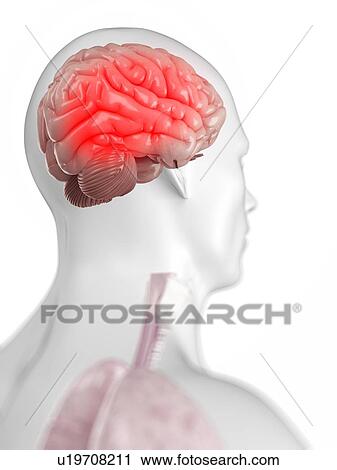 Clip Art - Headache, conceptual artwork. Fotosearch