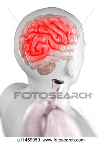 Drawing - Headache, conceptual artwork. Fotosearch