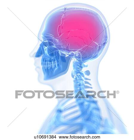Stock Illustration - Headache, conceptual artwork. Fotosearch