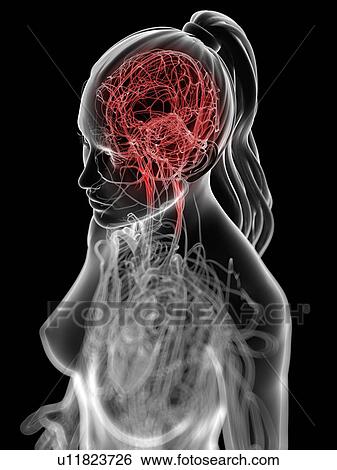 Headache, conceptual artwork View Large Illustration Stock Illustration - Headache, conceptual artwork. Fotosearch