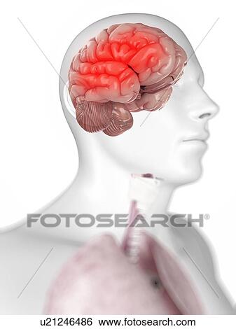 Headache, conceptual artwork View Large Illustration Stock Illustration - Headache, conceptual artwork. Fotosearch