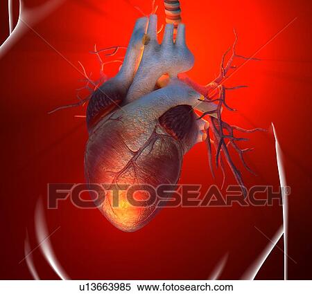 Heart attack, conceptual artwork View Large Illustration Stock Illustration - Heart attack, conceptual artwork. Fotosearch