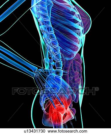 Hip pain, conceptual artwork View Large Illustration Clipart - Hip pain, conceptual artwork. Fotosearch