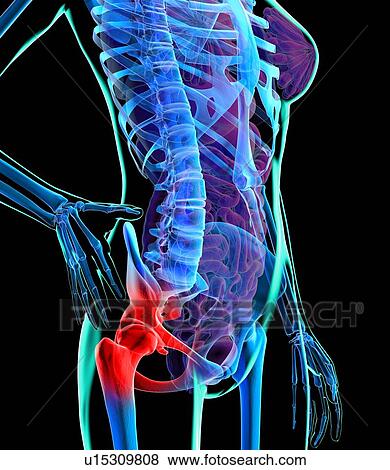 Stock Illustration - Hip pain, conceptual artwork. Fotosearch