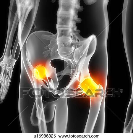 Hip pain, conceptual artwork View Large Illustration Stock Illustration - Hip pain, conceptual artwork. Fotosearch