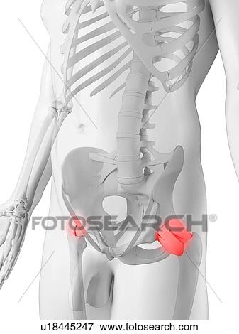 Hip pain, conceptual artwork View Large Illustration Stock Illustration - Hip pain, conceptual artwork. Fotosearch