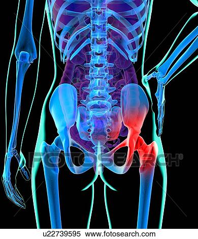 Hip pain, conceptual artwork View Large Illustration Stock Illustration - Hip pain, conceptual artwork. Fotosearch