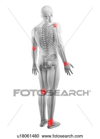 Joint pain, conceptual artwork View Large Illustration Clipart - Joint pain, conceptual artwork. Fotosearch