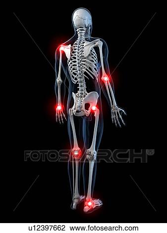 Joint pain, conceptual artwork View Large Illustration Drawing - Joint pain, conceptual artwork. Fotosearch