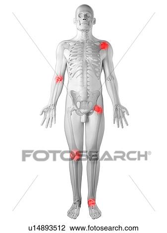 Joint pain, conceptual artwork View Large Illustration Drawing - Joint pain, conceptual artwork. Fotosearch