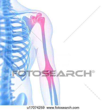 Joint pain, conceptual artwork View Large Illustration Stock Illustration - Joint pain, conceptual artwork. Fotosearch