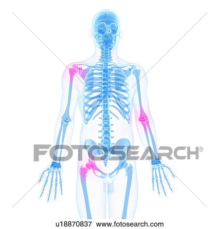 Stock Illustration - Joint pain, conceptual artwork. Fotosearch