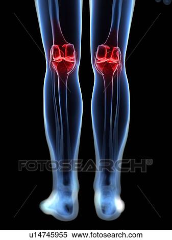 Knee pain, conceptual artwork View Large Illustration Stock Illustration - Knee pain, conceptual artwork. Fotosearch