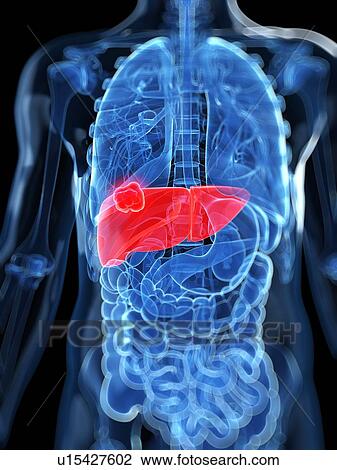 Liver cancer, artwork View Large Illustration Drawing - Liver cancer, artwork. Fotosearch